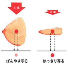 まんも２